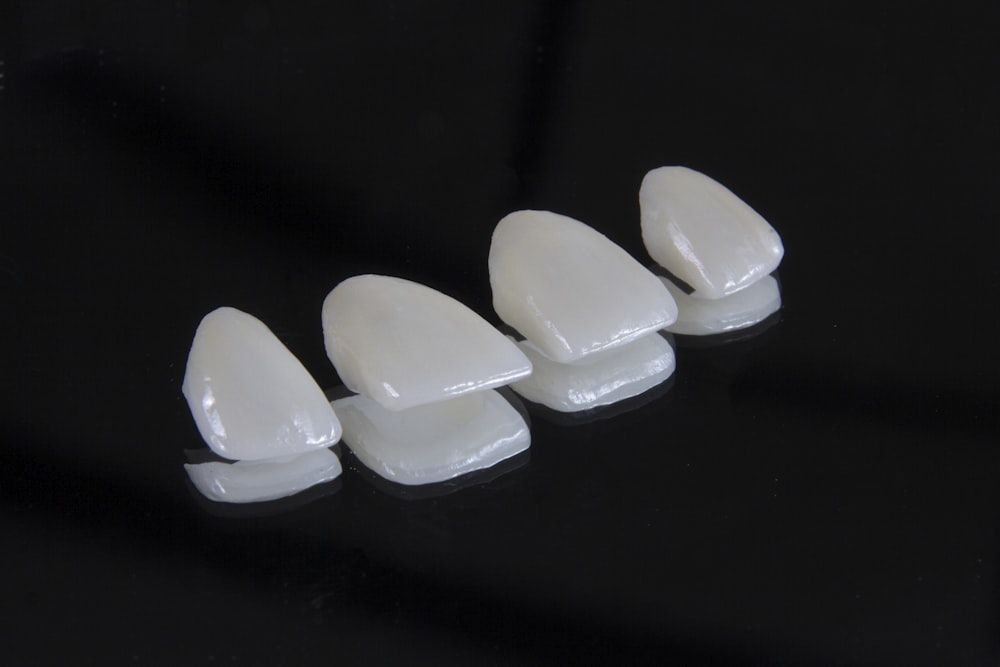Porcelain veneers — Custom lab-fab